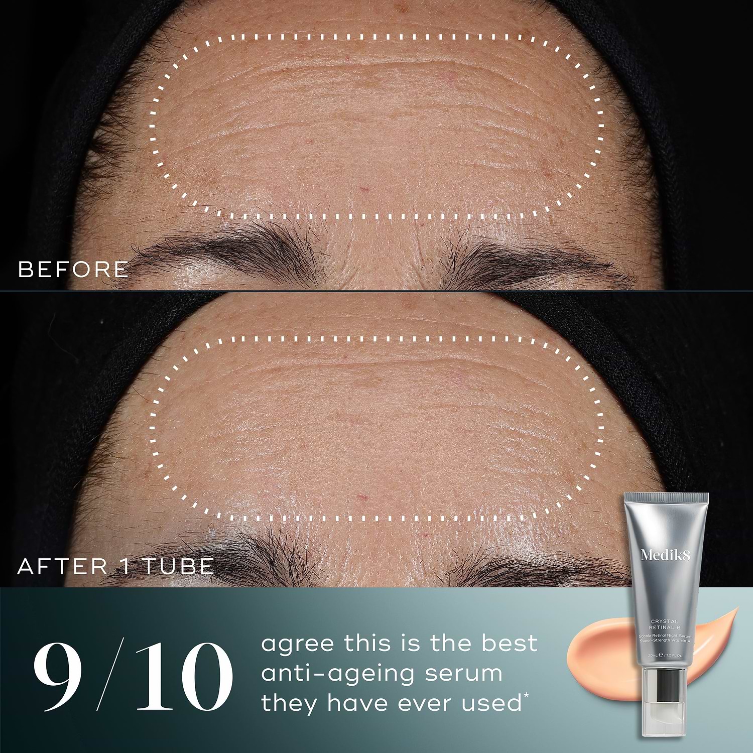 Medik8 Crystal Retinal 6 before and after results
