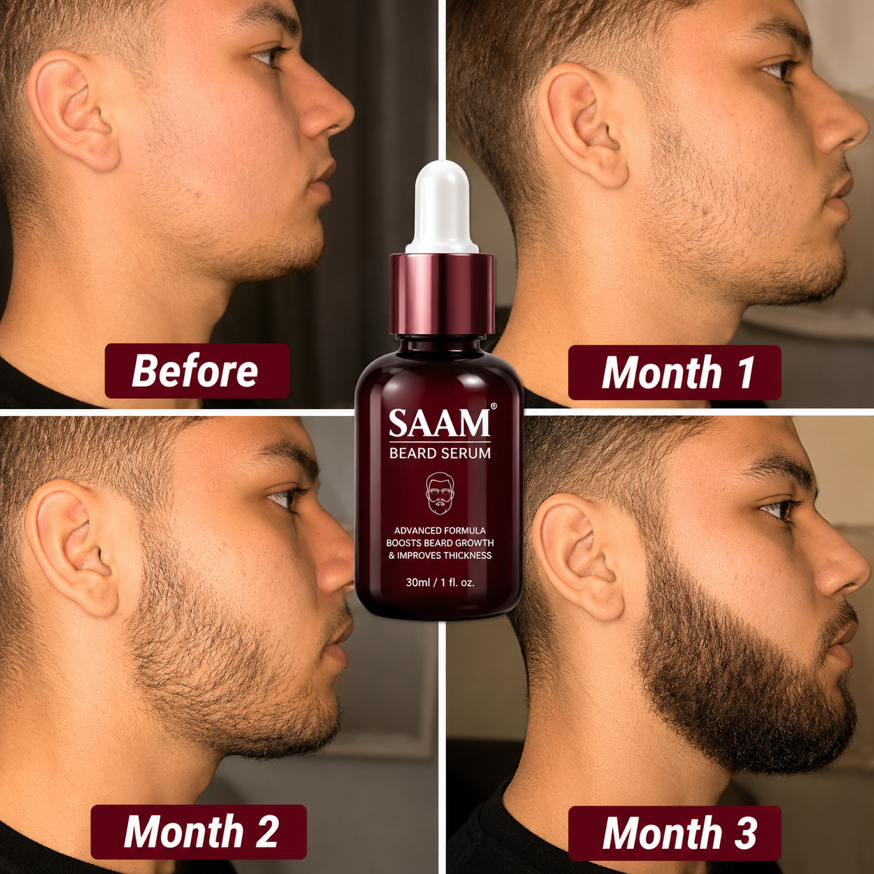 SAAM Beard Serum before and 3-month results