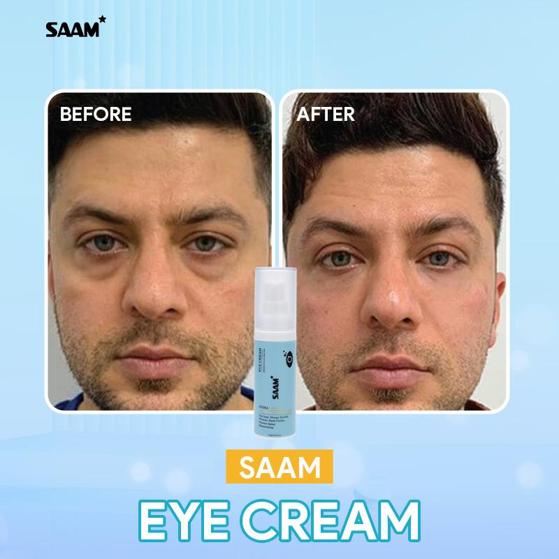 SAAM Eye Cream before and after results