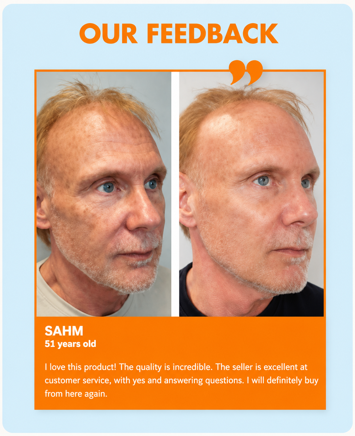 Customer feedback before and after using SAAM Perfect UV Sunscreen