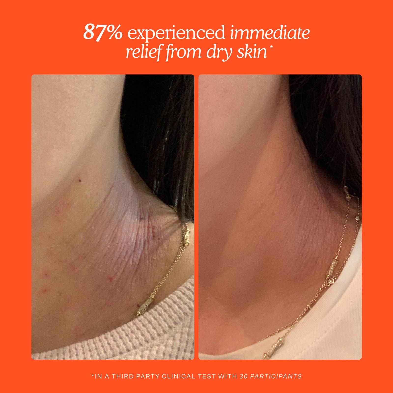 Before and after results for dry skin relief