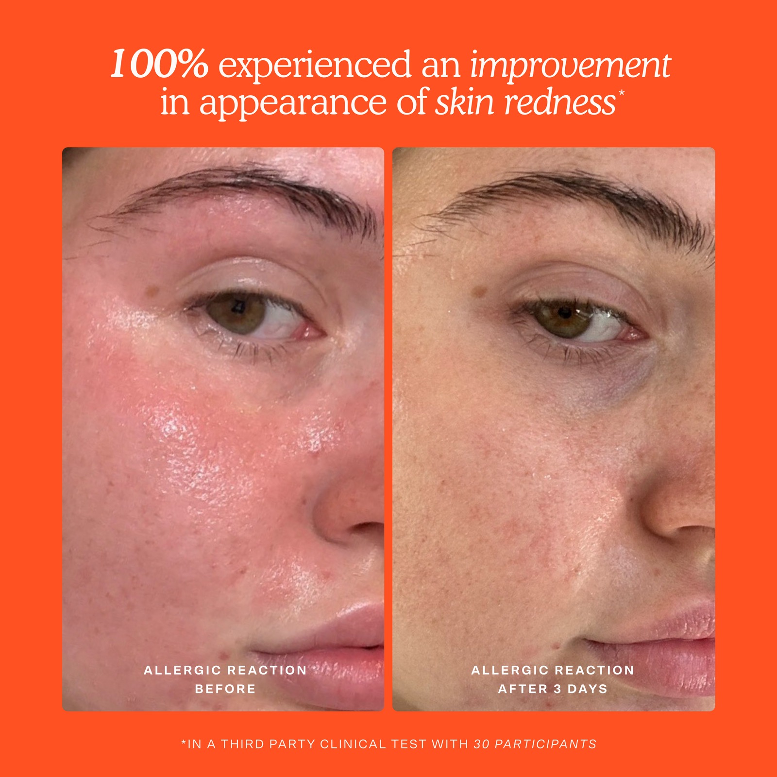 Before and after results for skin redness